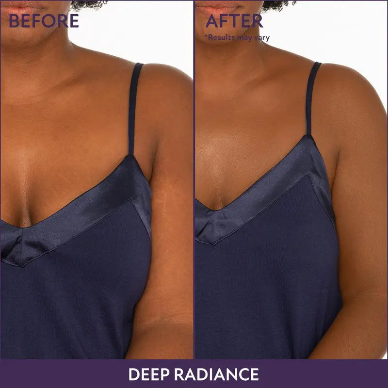 Covers Scars & Stretch Marks — Looks Like Real Skin